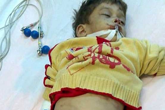 خاله سنگدل کودک 4 ساله را زیر شکنجه کشت +عکس