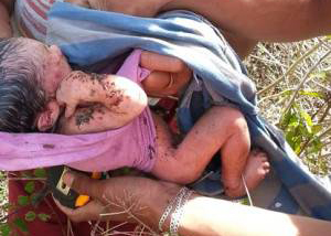 بدن کودک رها شده در جنگل لانه حشرات شد (عکس)