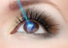 عمل لیزیک چشم عوارضی دارد؟