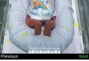 تولد نوزادی که در ایتالیا سمبل امید شد! + عکس