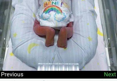 تولد نوزادی که در ایتالیا سمبل امید شد! + عکس