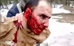 بازداشت سومین عامل حمله تروریستی در مسکو با چهره ای خون آلود+ فیلم